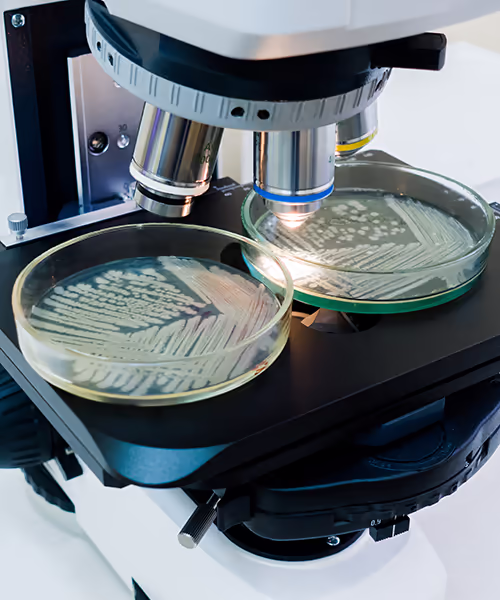 2 petri dishes under a microscope. Legionella frequently asked questions.