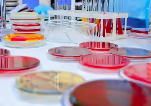 Petri dishes with cultures. Pace® Microbiology Food Testing Services